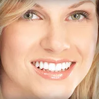 Close-up of veneers
